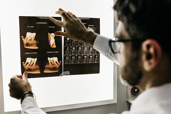3D Scanner